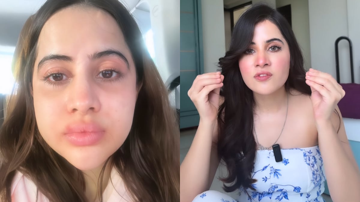‘It Was Allergy, Not Fillers’: Uorfi Javed Debunks Speculations Over Her Viral Swollen Face Pictures