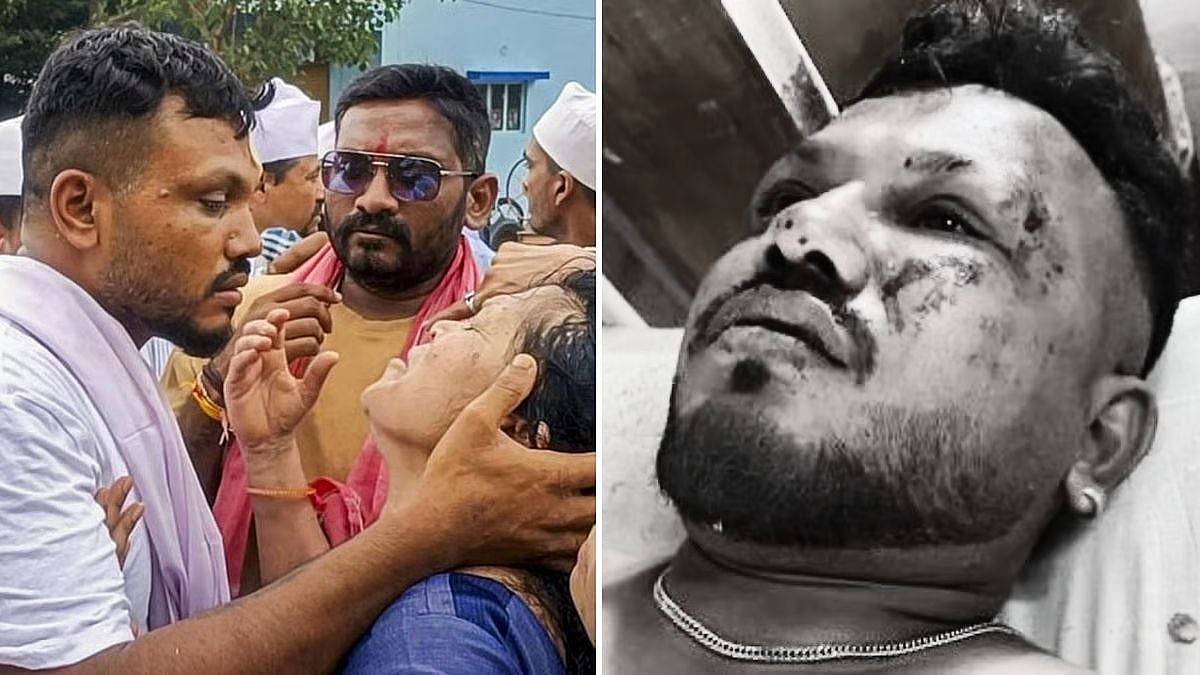 AI-171 Crash: The Inside Story Of The Lone Survivor & The Medical Heroes At Ahmedabad Civil Hospital