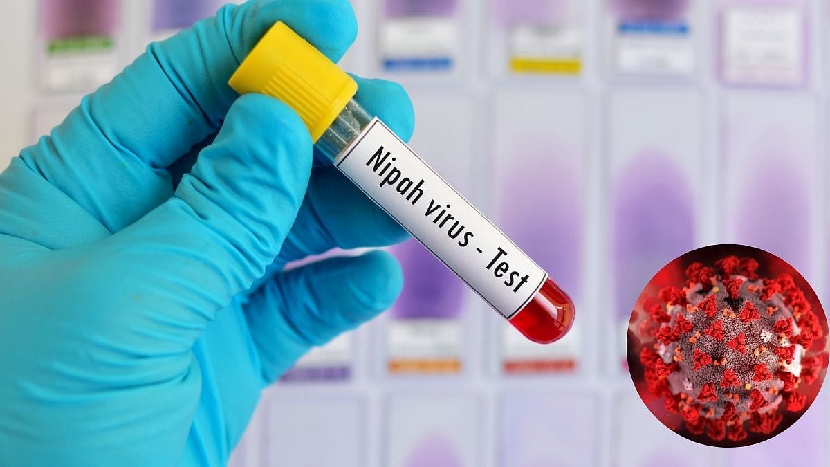 Nipah Virus Outbreaks: How The Deadly Zoonotic Disease Affects Humans