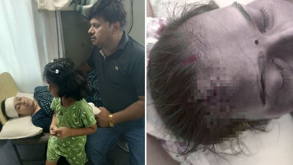 Lady Passenger Injured While Attempting To Board A Moving Train In Bhopal