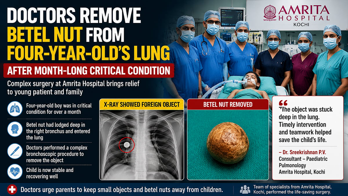 Amrita Hospital Doctors Remove Betel Nut From Four-Year-Old’s Lung After Month-Long Critical Condition