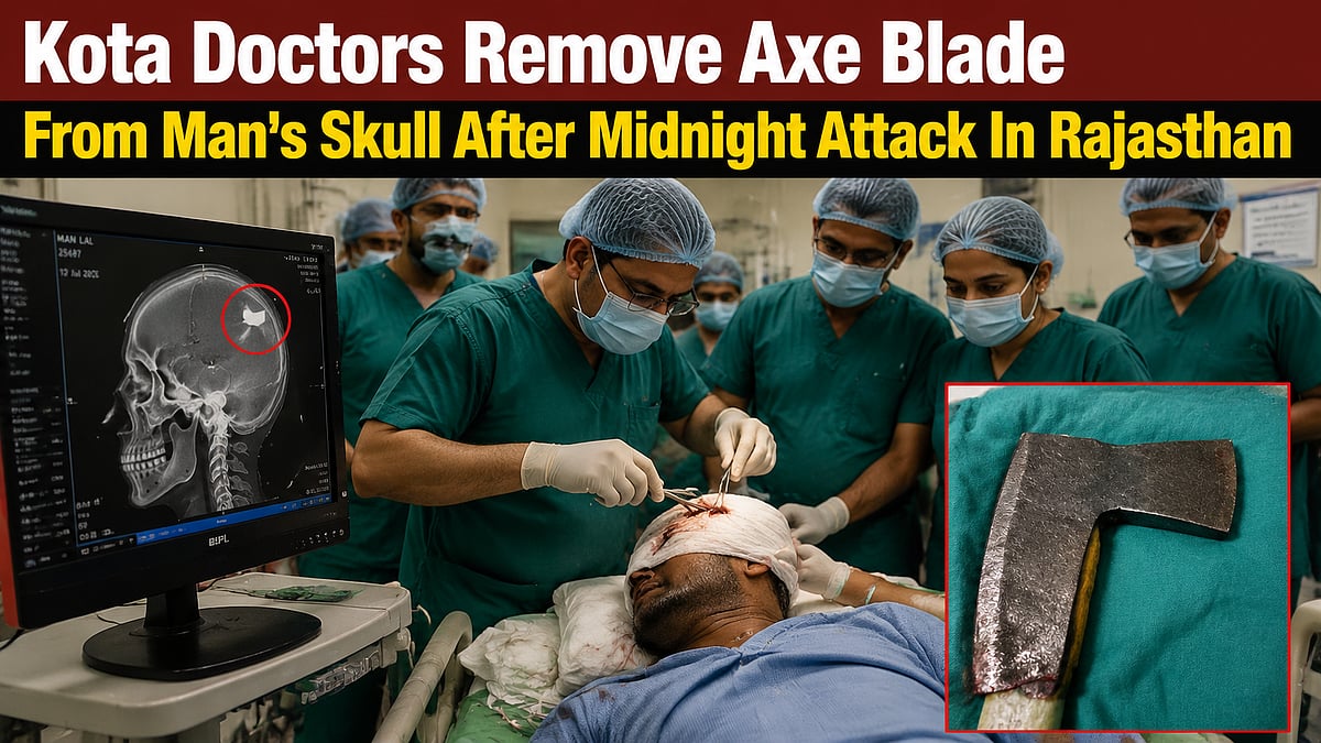 Kota Doctors Remove Axe Blade From Man's Skull After Midnight Attack In Rajasthan