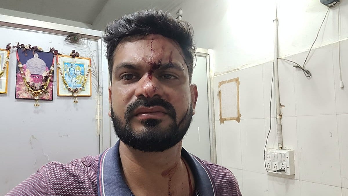 Odisha Man Dies After Allegedly Being Hit on Head With Mobile Phone During Domestic Dispute