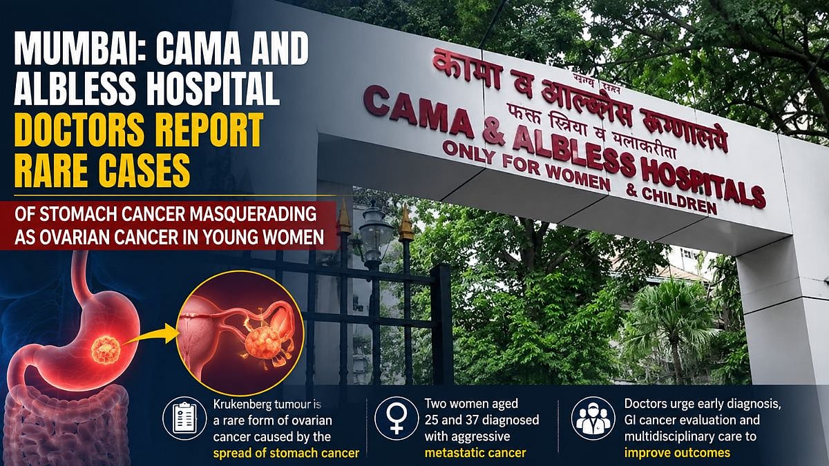 Mumbai: CAMA And Albless Hospital Doctors Report Rare Cases Of Stomach Cancer Masquerading As Ovarian Cancer In Young Women