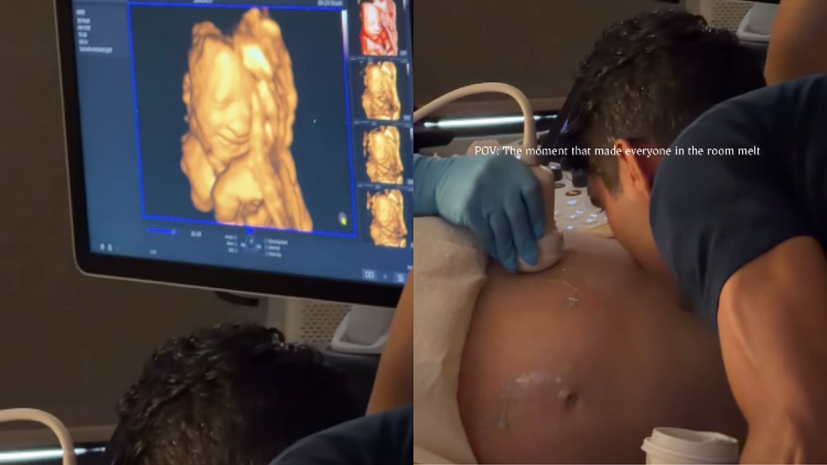 WATCH: Parents Witness Magical Moment As Unborn Baby Girl Smiles During Ultrasound Session; Heartwarming Video Goes Viral
