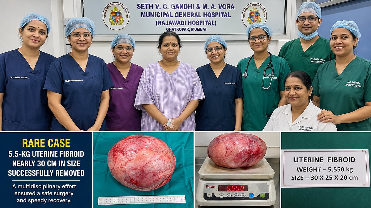 Mumbai: Rajawadi Hospital Doctors Remove Rare 5.5-Kg, 30-cm Uterine Fibroid In Complex Surgery