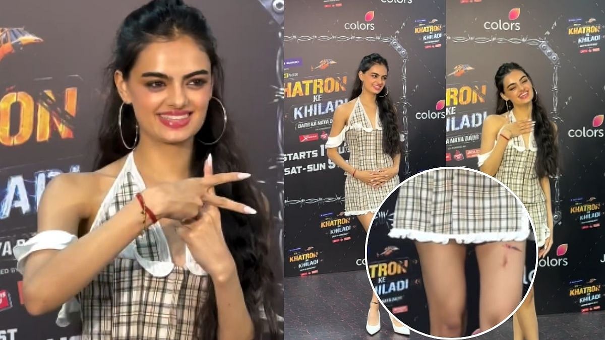 Was Ruhanika Dhawan Injured During Khatron Ke Khiladi 15? Visible Thigh Scars At Orry's Birthday Celebration Spark Concern- VIDEO