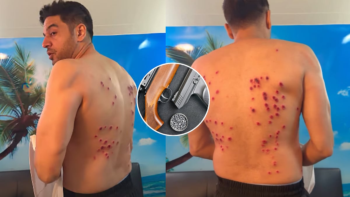 Did Khatron Ke Khiladi 15 Use Same 'Pellet Guns' As Those Used On NEET Protesters? Gaurav Khanna's Injury Sparks Buzz