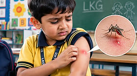 6-Year-Old LKG Student Bitten By Mosquito At School, Father Seeks DM Action