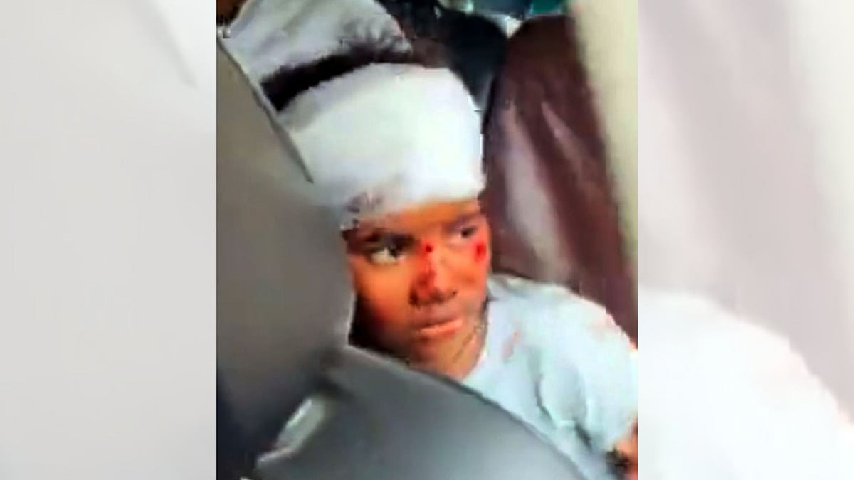 8-Year-Old Girl Injured After Bike-Borne Cops Chasing Accused Hit Her In Bhopal 