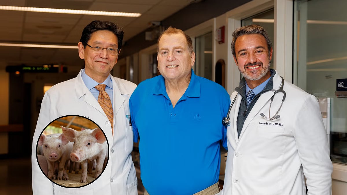 Man Spends 9 Months With Pig Kidney, Later Receives Human Organ In World-First Medical Milestone