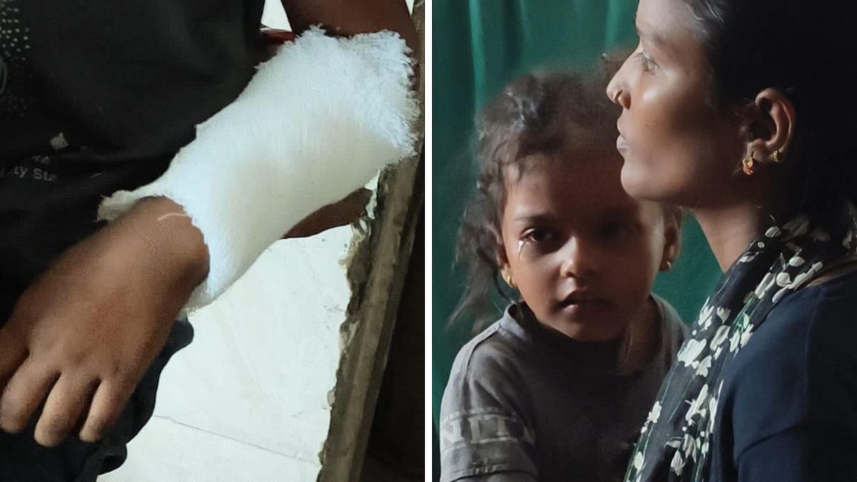 32 People Treated For Dog Bites In Kalatghar; Bhiwandi Records 3,292 Dog-Bite Cases In 4 Months