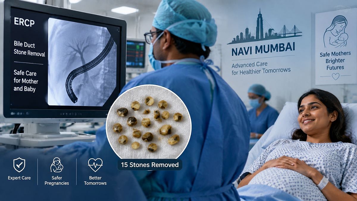 Navi Mumbai: Doctors Remove 15 Bile Duct Stones From 20-Week Pregnant Woman Using Minimal-Radiation ERCP At Medicover Hospitals