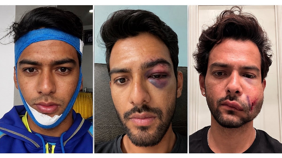 Unmukt Chand Shares Injury Update With Swollen Face Due To On-Field Collision A Day After Hitting Century; VIDEO