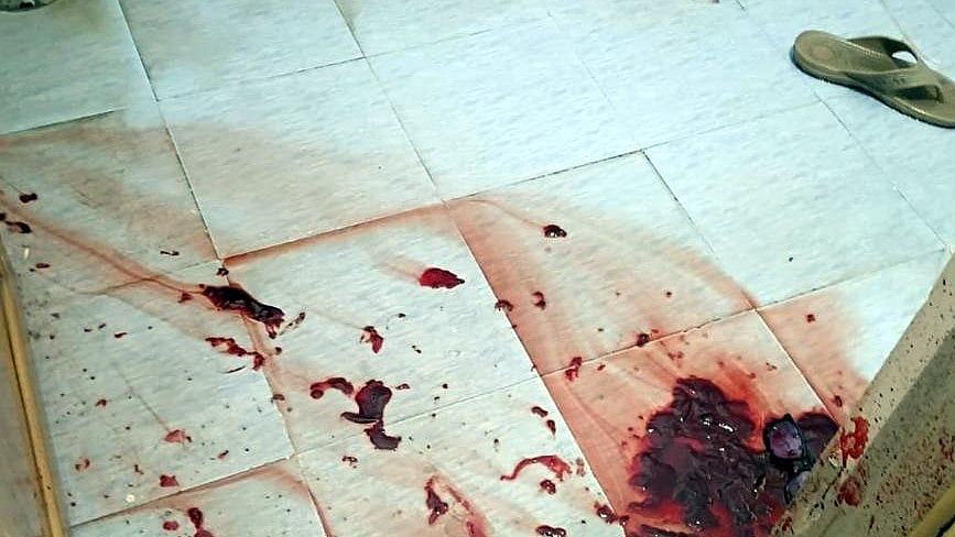 Bhopal Retired Mining Officer Attacked With Hammer During Robbery Bid, Caretaker Detained