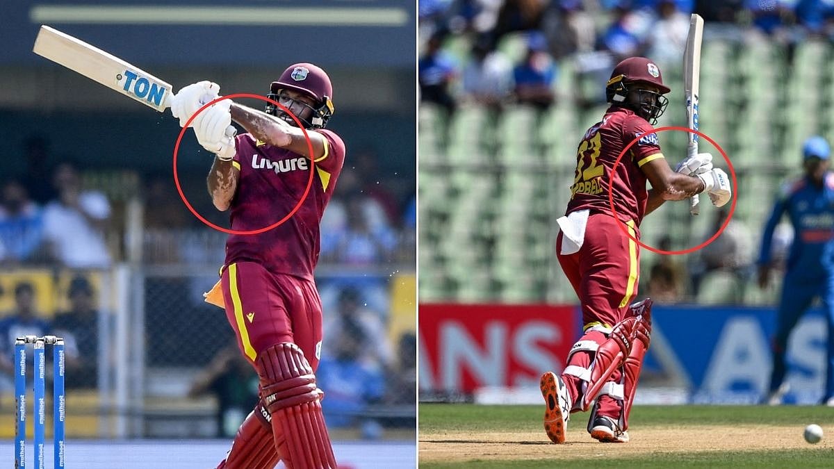 Ind Vs WI 2nd Guwahati ODI: What Are The White Patches On John Campbell's Skin? Know About This Health Condition Jamaican Batter Is Reeling From