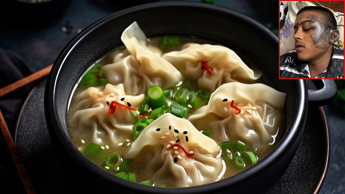 Gwalior Momos Dispute: Momo Seller Throws Pan Of Boiling Oil After Teen Boy Complains About Less Quantity