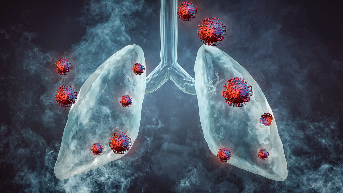 What Is Pneumonic Plague? Russia's Lab Death In Siberia Sparks Fears Of This Lung Disease, Know Symptoms And Risks