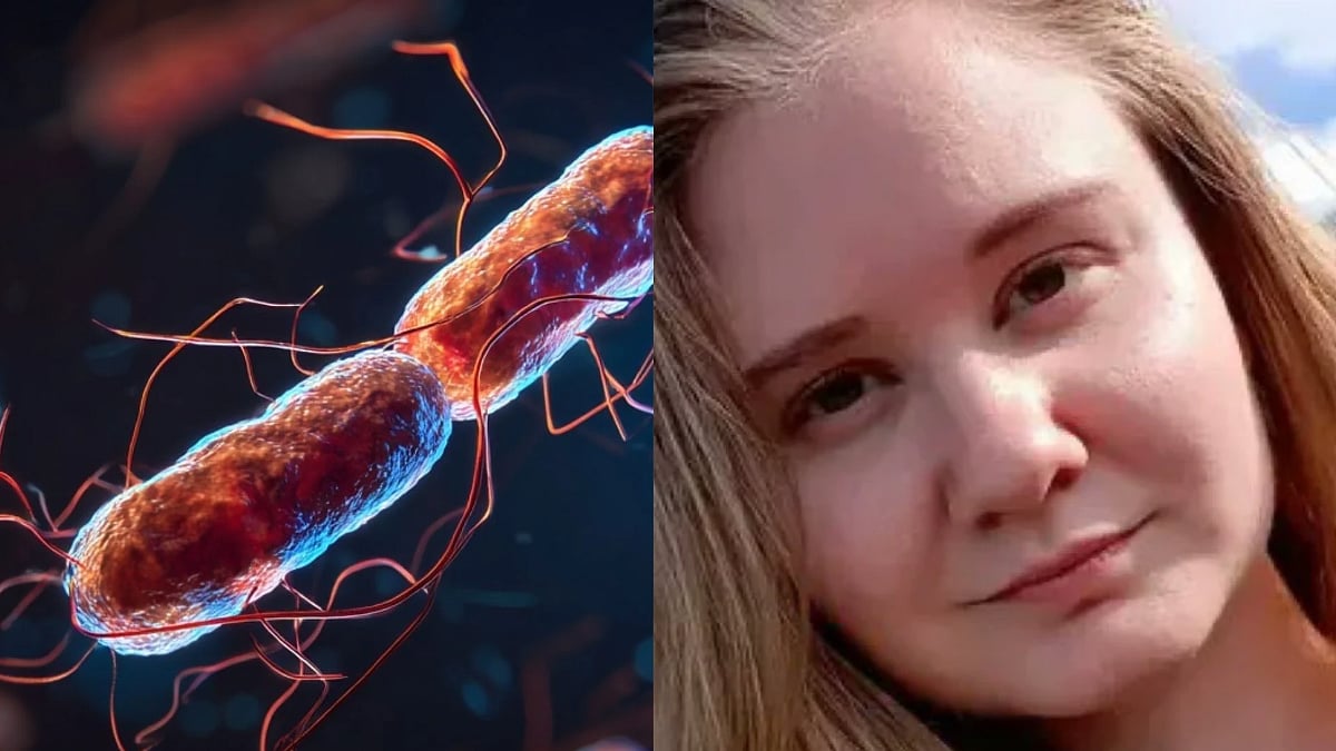 Russian Plague Scare: How The World Is Responding & What Has Changed