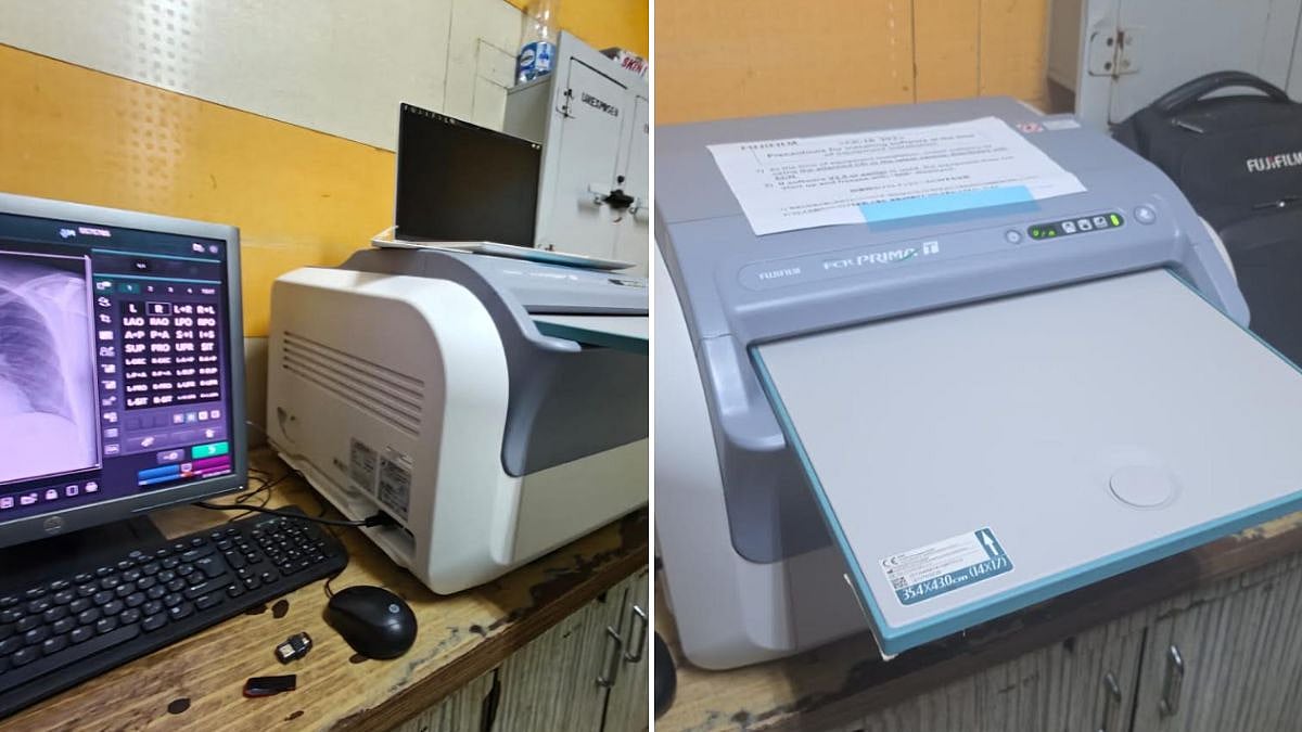 ₹55 Lakh X-Ray Machine Lies Unused For Nearly 5 Years At Jogeshwari Trauma Hospital, Finally Operational