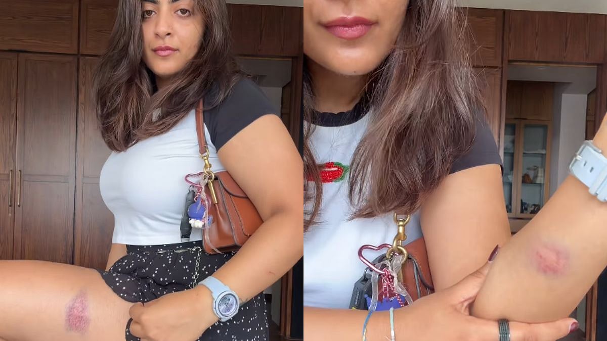 Aamir Khan's Niece Zayn Marie Shows Injury Marks After Mumbai Police Detention During CJP Protest, Says 'Don't Scare Us So Much That...' - VIDEO 