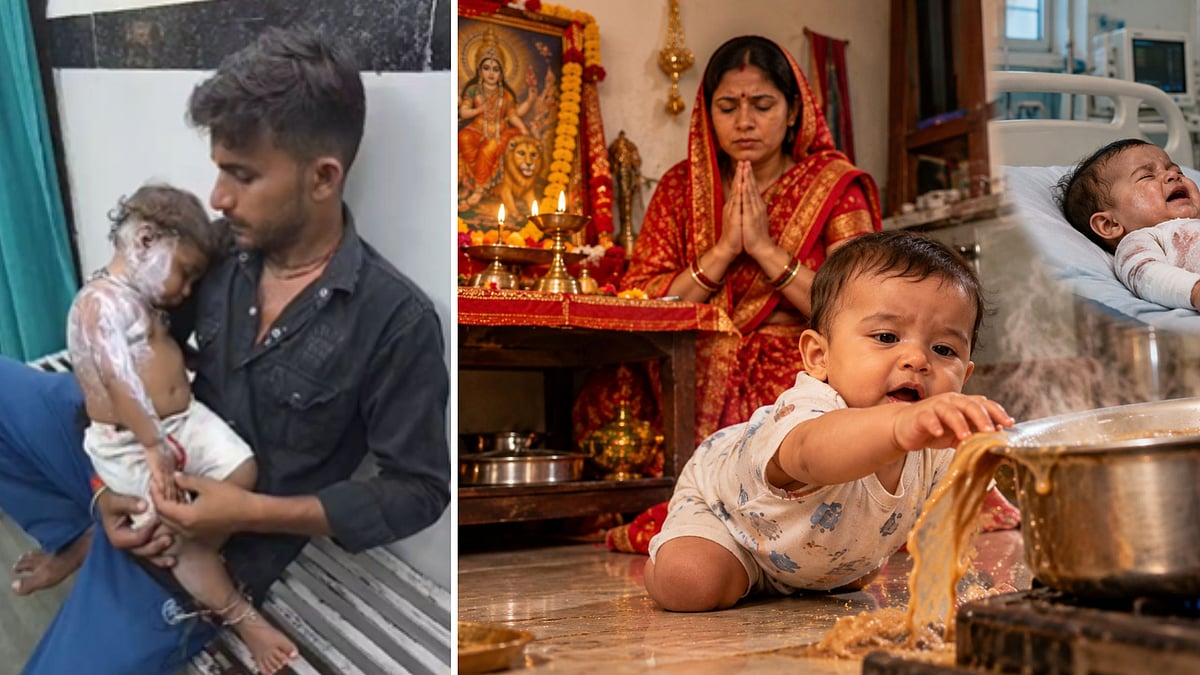 Six-Month-Old Baby Critically Burned After Boiling Tea Spills On Him While Mom Performs Navratri Puja In MP's Chhatarpur