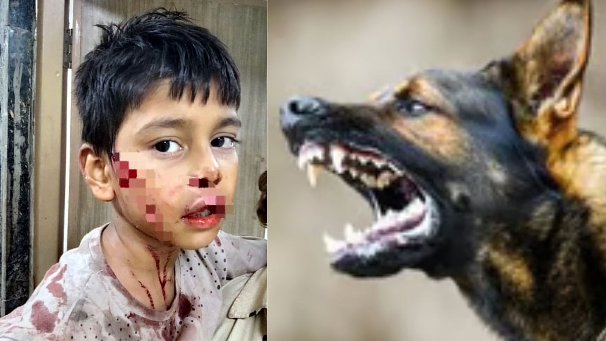 Stray Dog Mauls Eight-Year-Old Boy's Face; 15 Attacked In Shahjahanabad In 5 Days 