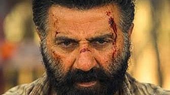 Nashik: IMA Seeks CBFC Review Of Sunny Deol’s ‘Surya’ Over Portrayal Of Violence Against Doctors