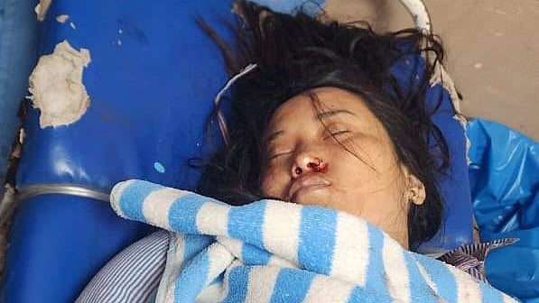 Indore Woman Falls To Death From Eighth Floor Of Tejaji Nagar Building, Live-In Partner Detained For Questioning