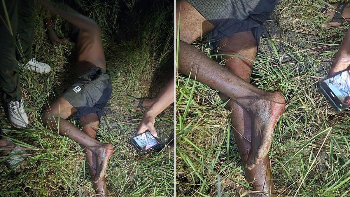 Palghar: Injured Man Mentions Leopard Attack In Umroli; Forest Officials Find No Pugmarks, Probe Underway