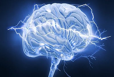 article-image