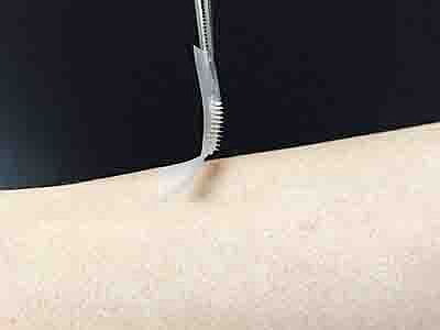 Diabetic? Smart  insulin patch could replace injections