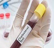 Fasting not necessary before a cholesterol test: Experts
