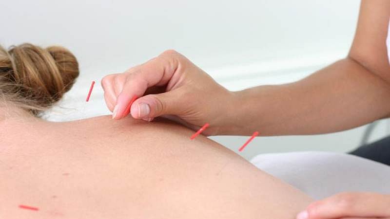 Acupuncture may ease menopausal symptoms
