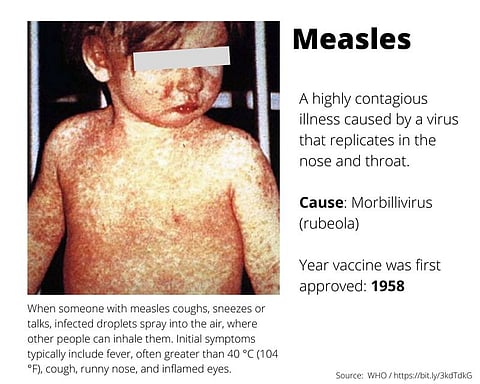 US vaccine watchdog effort begins as measles surge draws alarm