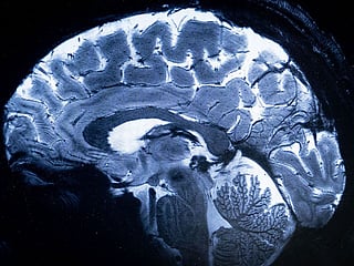 Brain-eating amoeba scare: Kerala on alert as 17 die