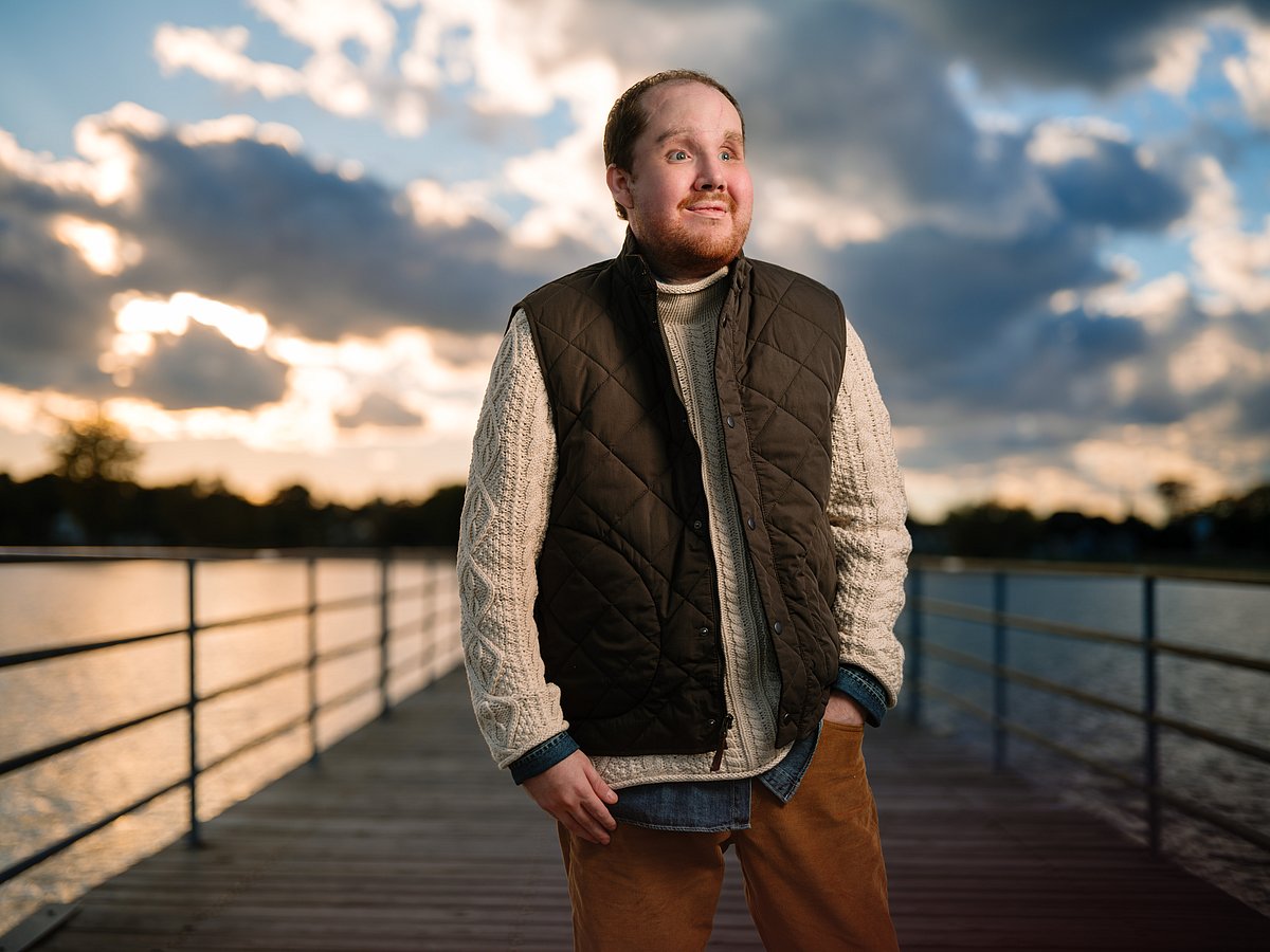 Derek Pfaff face transplant Mayo Clinic
