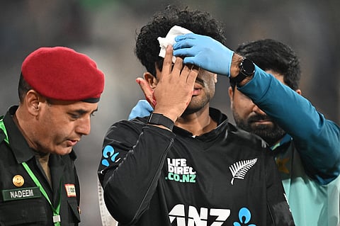 New Zealand's Rachin Ravindra (C) receives medical attention after being hit on the head by the ball during the Tri-Nation's first one-day international cricket match between Pakistan and New Zealand at the Gaddafi Stadium in Lahore on February 8, 2025.