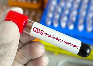 There are other 27 cases who are suspected of being infected with GBS.