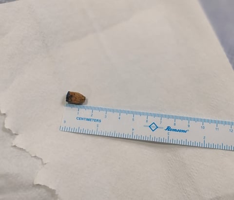 If a child accidentally swallows any object, immediate medical attention is necessary to prevent severe complications.