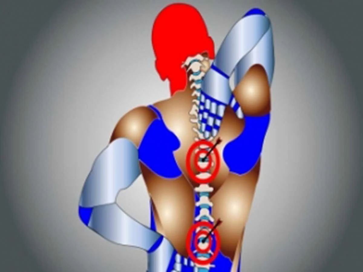Illustrative image. 