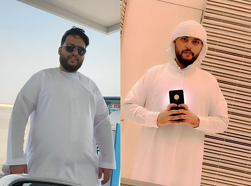  Abdulla Alqattan poses for photos before and after losing 35gk of weight