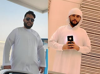 UAE: Robotic surgery helps 120kg Emirati man lose 35kg, reduce obesity