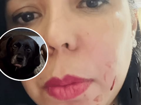 The incident has led Filipina actress Alma Concepcion and her family to make significant changes in how they interact with their beloved pet.

