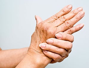 Rheumatoid arthritis is characterised by joint inflammation, pain, and swelling, which can lead to joint deformities and functional disabilities in severe cases.