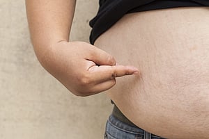 Saudi Arabia: Fines up to SR100,000 for unprescribed weight-loss injections