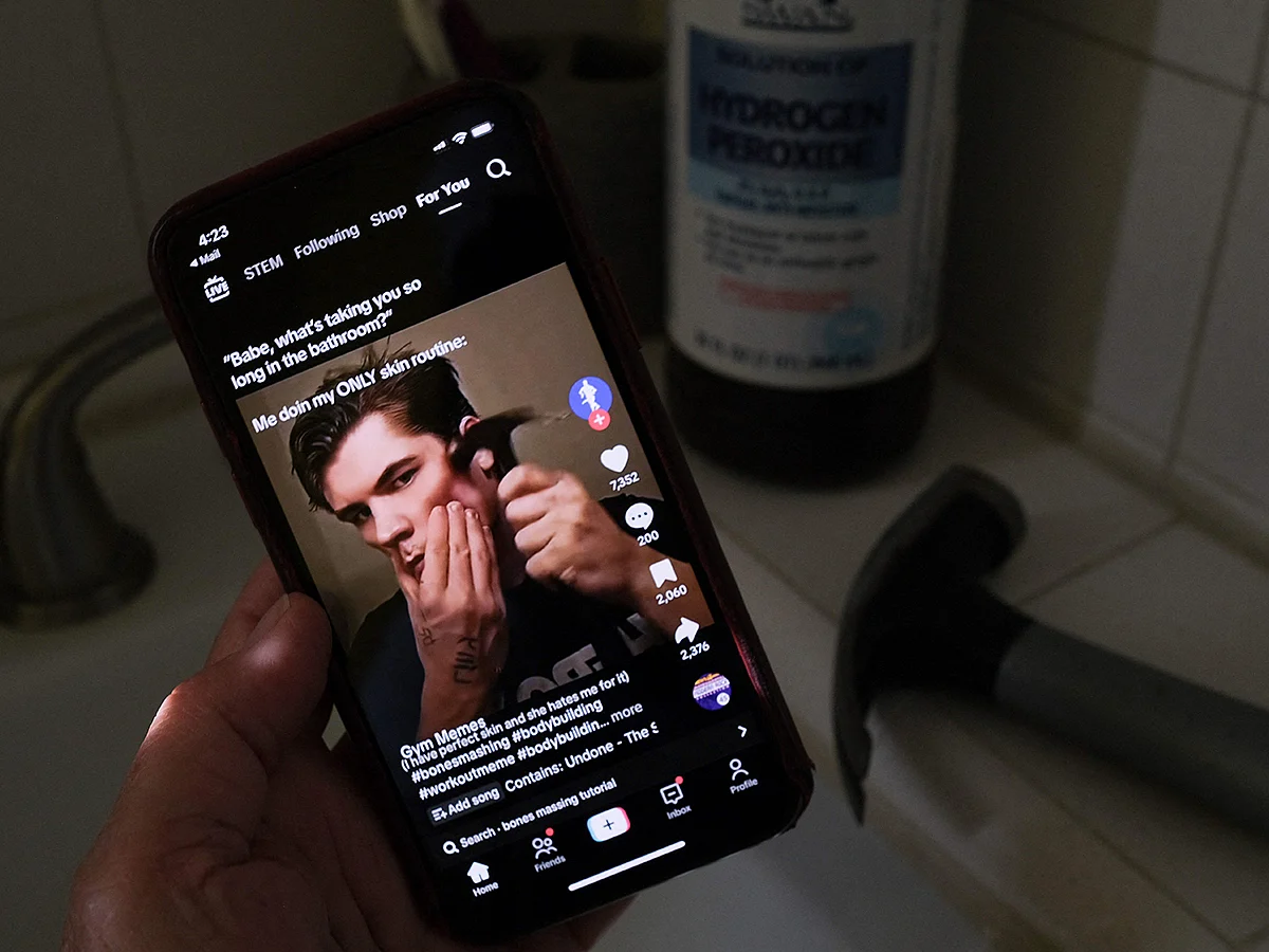 This illustration photo shows a video of male TikTok influencer hammering his cheekbone, playing on a smartphone in a bathroom next to a bottle of hydrogen peroxide and a hammer in Los Angeles, April 11, 2025. 