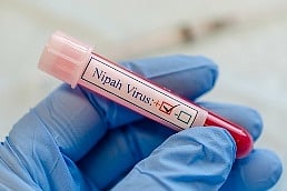 First identified in Malaysia in 1999, the Nipah virus has triggered several deadly outbreaks across South and Southeast Asia.
