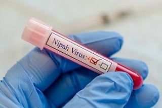 A 43-year-old man is suspected to have contracted the Nipah virus while carrying out cleaning work at a structure with a heavy bat presence in Kozhikode.