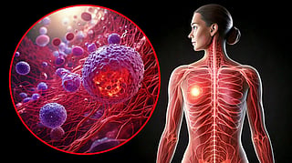 Filipino researchers develop model to  detect early cancer tumour spread
